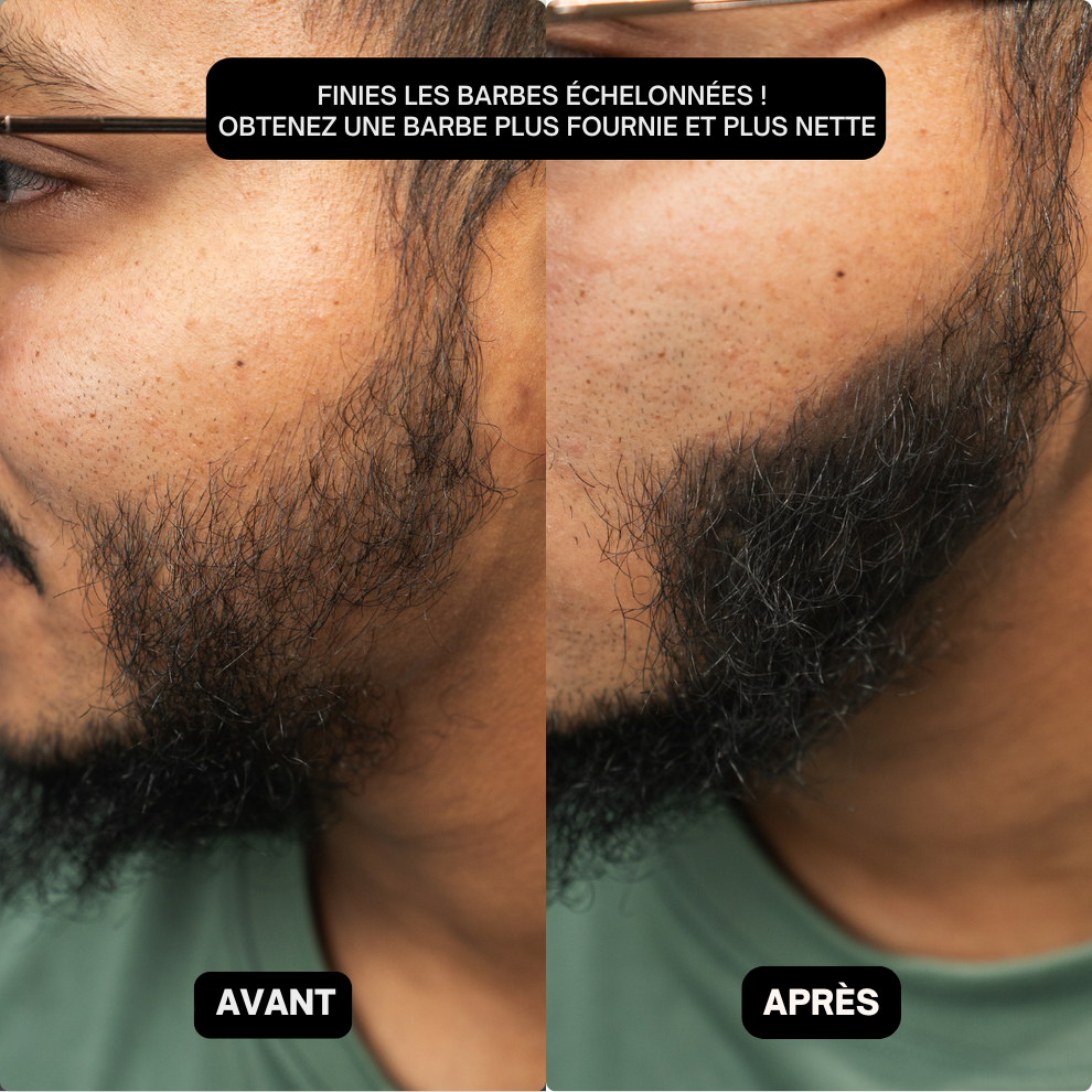 Poudre de remplissage capillaire