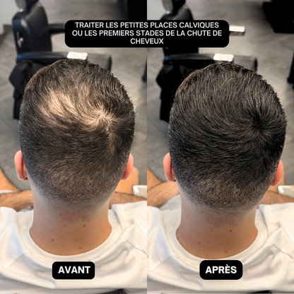 Poudre de remplissage capillaire