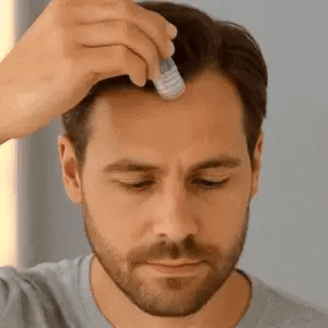Système de repousse des cheveux AlphaInfuse™